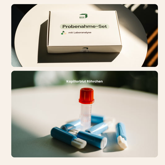 Test d’allergie (295 allergènes)