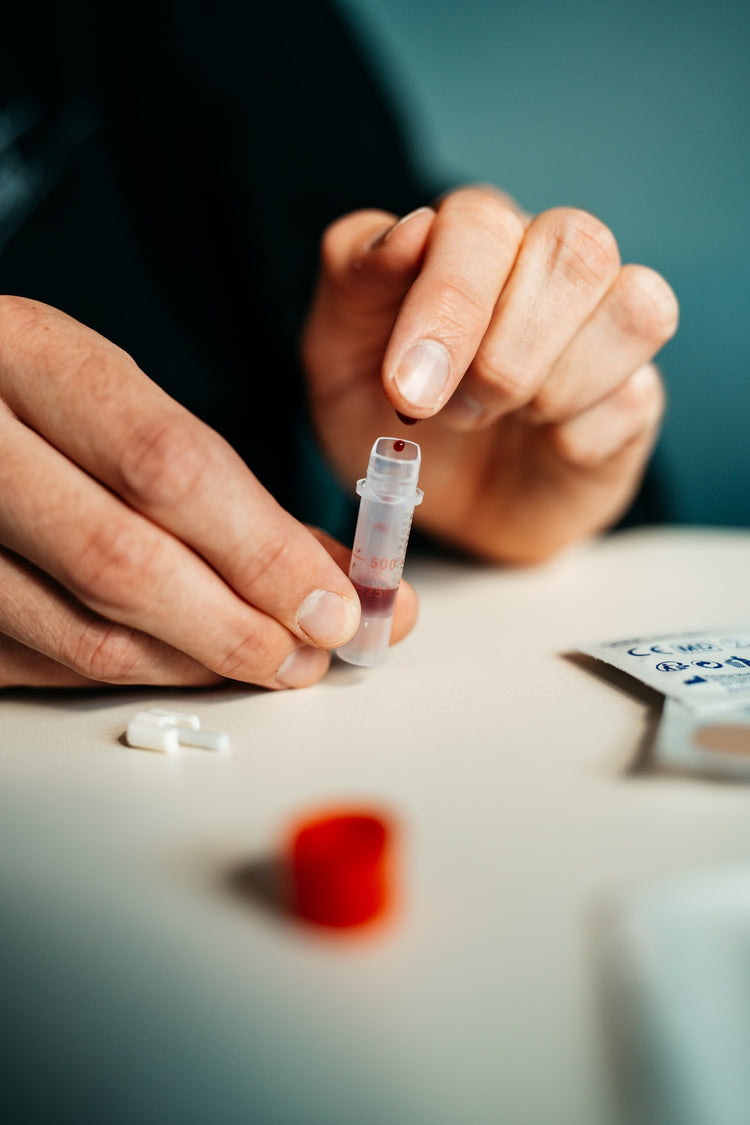 Kapillarblutentnahme: Blutstropfen wird in ein Probenröhrchen gegeben – Vorbereitung für eine Heimtest-Analyse.