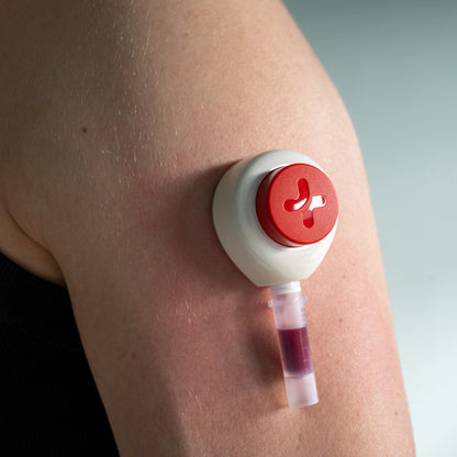 Test d’allergie (295 allergènes)